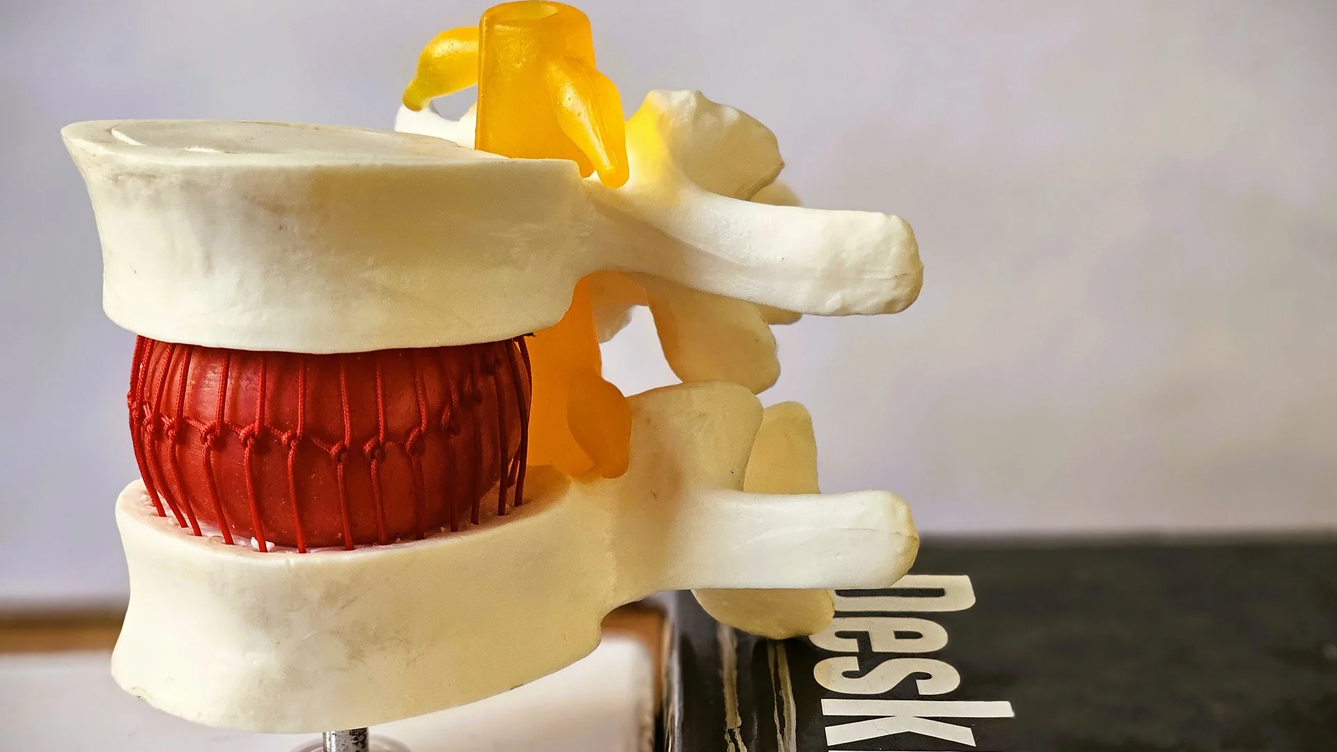 Mulaj anatomic cu două vertebre lombare și discul intervertebral dintre ele, în centrul RESET